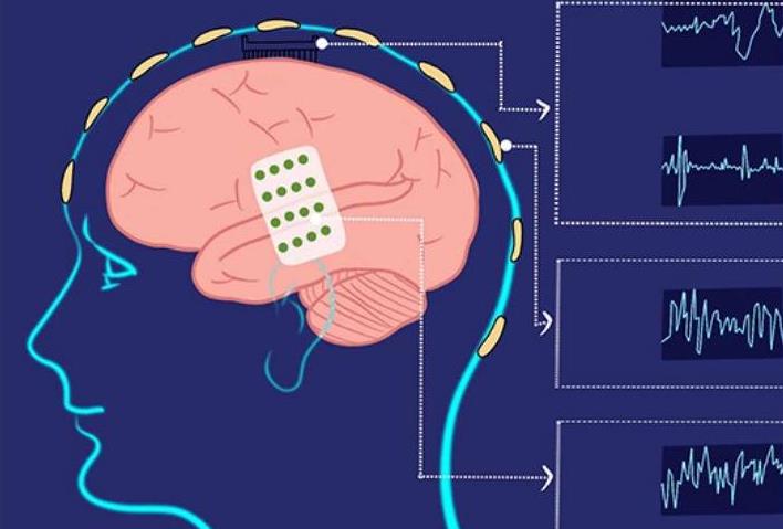 emo了属于是_whatsapp是属于什么_属于是什么意思数学